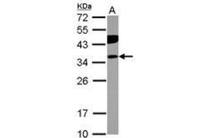 Image no. 2 for anti-Phosphotidylinositol Transfer Protein, beta (PITPNB) (AA 1-266) antibody (ABIN1500227)