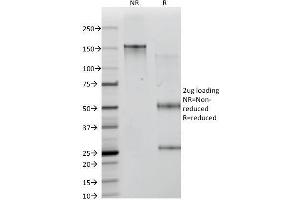 SDS-PAGE Analysis Purified ICOS-L Mouse Monoclonal Antibody (ICOSL/3111). (ICOSLG Antikörper  (AA 23-149))