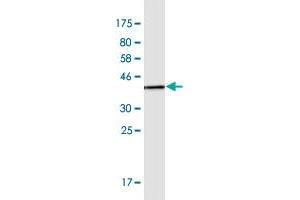 Western Blot detection against Immunogen (37. (CTNND2 Antikörper  (AA 1081-1190))