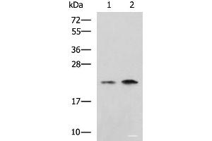 Western blot analysis of Jurkat Raji cell lysates using CHMP6 Polyclonal Antibody at dilution of 1:1000 (CHMP6 Antikörper)