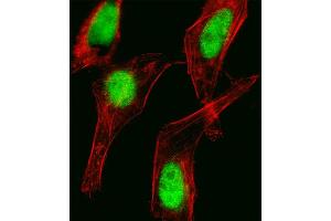 Fluorescent image of Hela cell stained with HOXC10 Antibody (C-term) (ABIN1881429 and ABIN2838971). (HOXC10 Antikörper  (C-Term))
