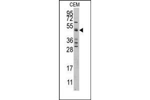 Image no. 1 for anti-Caspase 9, Apoptosis-Related Cysteine Peptidase (CASP9) (Middle Region) antibody (ABIN360397) (Caspase 9 Antikörper  (Middle Region))
