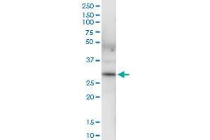 Immunoprecipitation (IP) image for anti-3-hydroxybutyrate Dehydrogenase, Type 1 (BDH1) (AA 1-343) antibody (ABIN513697)