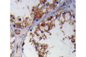 Used in DAB staining on fromalin fixed paraffin-embedded testis tissue (WNK1 Antikörper  (AA 1954-2231))