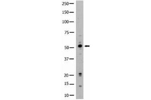 Image no. 1 for anti-Hemopoietic Cell Kinase (HCK) (N-Term) antibody (ABIN359984) (HCK Antikörper  (N-Term))