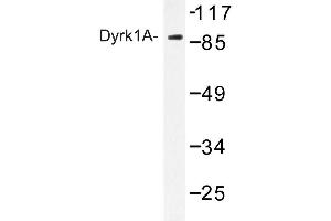 Image no. 1 for anti-Dual-Specificity tyrosine-(Y)-phosphorylation Regulated Kinase 1A (DYRK1A) antibody (ABIN272227) (DYRK1A Antikörper)