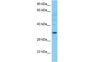 Western Blotting (WB) image for anti-Hydroxysteroid (11-Beta) Dehydrogenase 1 (HSD11B1) (N-Term) antibody (ABIN2773867)