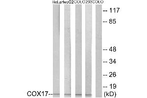 Immunohistochemistry analysis of paraffin-embedded human liver carcinoma tissue using COX17 antibody. (COX17 Antikörper)