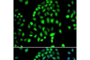 Immunofluorescence analysis of MCF-7 cells using PARP3 Polyclonal Antibody (PARP3 Antikörper)