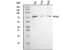 Western blot analysis of DPY19L1 using anti-DPY19L1 antibody (ABIN7601445).