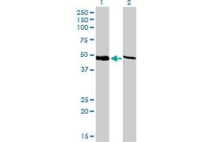 Western Blot analysis of PSMC4 expression in transfected 293T cell line by PSMC4 monoclonal antibody (M01), clone 3G8. (PSMC4 Antikörper  (AA 1-418))