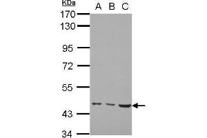 WB Image Sample (30 ug of whole cell lysate) A: H1299 B: HCT116 C: MCF-7 7. (MMP19 Antikörper)