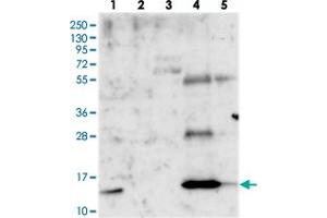Western blot analysis of Lane 1: RT-4, Lane 2: U-251 MG, Lane 3: Human Plasma, Lane 4: Liver, Lane 5: Tonsil with PLAC8 polyclonal antibody .