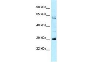 Image no. 1 for anti-Hydroxysteroid (17-Beta) Dehydrogenase 8 (HSD17B8) (AA 51-100) antibody (ABIN6747948) (HSD17B8 Antikörper  (AA 51-100))