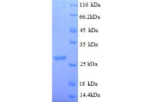 SDS-PAGE (SDS) image for Abscisic Acid Receptor PYL1 (PYL1) (AA 8-221), (partial) protein (His tag) (ABIN4975128) (Abscisic Acid Receptor PYL1 (PYL1) (AA 8-221), (partial) protein (His tag))