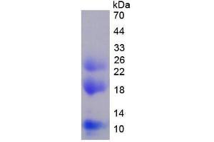 Image no. 2 for Matrix Metallopeptidase 9 (Gelatinase B, 92kDa Gelatinase, 92kDa Type IV Collagenase) (MMP9) (AA 226-391) protein (His tag) (ABIN1980763)