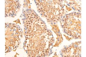 Immunohistochemistry (IHC) image for anti-Lamin A/C (LMNA) (pSer392) antibody (ABIN6256311)