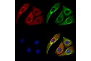 ABIN6261602 and ABIN6273043 staining Hela cells by IF/ICC.