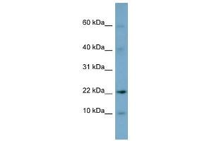 DPPA5 antibody used at 1 ug/ml to detect target protein. (DPPA5 Antikörper  (N-Term))