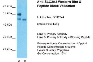 Host: Rabbit  Target Name: SLC2A2  Sample Tissue: Fetal LungLane A:  Primary Antibody Lane B:  Primary Antibody + Blocking Peptide Primary Antibody Concentration: 1 µg/mL Peptide Concentration: 5 µg/mL Lysate Quantity: 41 µg/laneGel Concentration:.