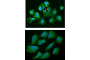 ICC/IF analysis of AHA1 in Hep3B cells line, stained with DAPI (Blue) for nucleus staining and monoclonal anti-human AHA1 antibody (1:100) with goat anti-mouse IgG-Alexa fluor 488 conjugate (Green). (AHSA1 Antikörper  (AA 19-337))