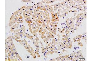 Formalin-fixed and paraffin embedded rat heart tissue labeled with Anti-STAT2 Polyclonal Antibody, Unconjugated  at 1:200 followed by conjugation to the secondary antibody and DAB staining (STAT2 Antikörper  (AA 151-250))