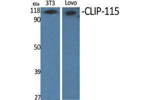 Western Blot (WB) analysis of specific cells using CLIP-115 Polyclonal Antibody. (CLIP2 Antikörper  (C-Term))
