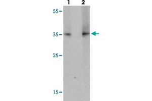 Western blot analysis of TLX1 in mouse spleen tissue with TLX1 polyclonal antibody  at (lane 1) 1 ug/mL and (lane 2) 2 ug/mL. (TLX1 Antikörper  (N-Term))