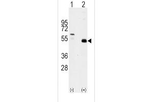 Western blot analysis of TRAF2 (arrow) using rabbit polyclonal TRAF2 Antibody (C-term) (ABIN392282 and ABIN2841948). (TRAF2 Antikörper  (C-Term))