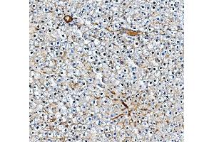 IHC analysis of Pecam1 using anti-Pecam1 antibody (ABIN7601672). (CD31 Antikörper  (AA 41-491))