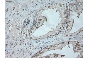 Immunohistochemical staining of paraffin-embedded lung tissue using anti-NEUROG1mouse monoclonal antibody. (Neurogenin 1 Antikörper)