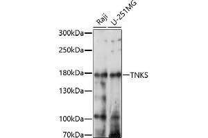 Western blot analysis of extracts of various cell lines, using TNKS antibody (ABIN7270725) at 1:1000 dilution. (TNKS Antikörper  (AA 1050-1150))