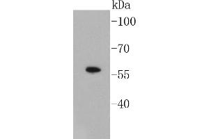 Lane 1: A549 Cell lysates, probed with Smad3 (3D1) Monoclonal Antibody  at 1:1000 overnight at 4˚C. (SMAD3 Antikörper)