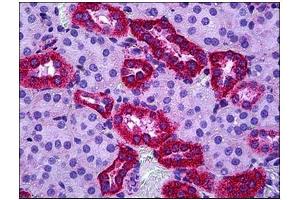 Human Renal Tubules: Formalin-Fixed, Paraffin-Embedded (FFPE) (TSPO Antikörper  (C-Term))