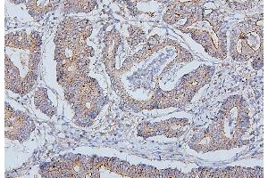 IHC analysis of PDCD6IP using anti-PDCD6IP antibody (ABIN7600490). (ALIX Antikörper  (AA 2-330))