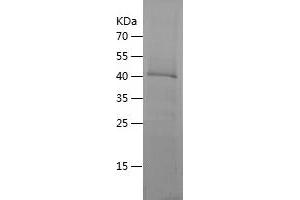 Western Blotting (WB) image for Eukaryotic Translation Initiation Factor 2, Subunit 3 Gamma, 52kDa (EIF2S3) (AA 10-204) protein (His-IF2DI Tag) (ABIN7122839)