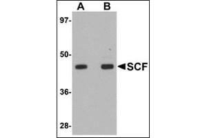 Western blot analysis of SCF in rat brain tissue lysate with this product at (A) 1 and (B) 2 μg/ml. (KIT Ligand Antikörper  (Center))