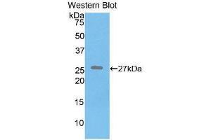 Western blot analysis of recombinant Human ELN. (Elastin Antikörper  (AA 392-645))