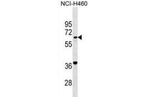 Western Blotting (WB) image for anti-PET112 Homolog (PET112) antibody (ABIN2999660) (PET112L Antikörper)