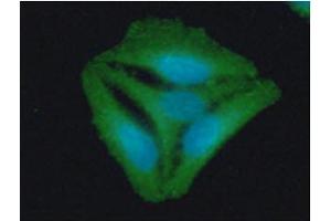 ICC/IF analysis of STOM in HeLa cells line, stained with DAPI (Blue) for nucleus staining and monoclonal anti-human STOM antibody (1:100) with goat anti-mouse IgG-Alexa fluor 488 conjugate (Green). (Stomatin Antikörper  (AA 55-288))