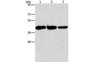 Western Blot analysis of Human normal liver tissue, Mouse brain and heart tissue using GOT1 Polyclonal Antibody at dilution of 1:1600 (GOT1 Antikörper)