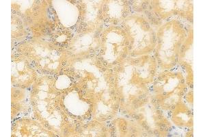 ABIN6263085 and ABIN6279557 at 1/100 staining human normal kidney tissue by IHC-P.