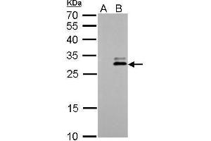 WB Image KLK7 antibody detects KLK7 protein by Western blot analysis. (Kallikrein 7 Antikörper)