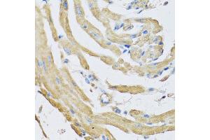Immunohistochemistry of paraffin-embedded mouse heart using SFRP4 antibody at dilution of 1:100 (40x lens). (SFRP4 Antikörper)