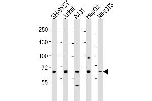 All lanes : Anti-MeCP2 Antibody at 1:2000 dilution Lane 1: SH-SY5Y whole cell lysates Lane 2: Jurkat whole cell lysates Lane 3: A431 whole cell lysates Lane 4: HepG2 whole cell lysates Lane 5: NIH/3T3 whole cell lysates Lysates/proteins at 20 μg per lane. (MECP2 Antikörper  (AA 400-428))