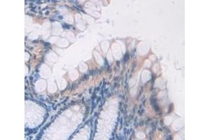IHC-P analysis of Mouse Tissue, with DAB staining. (BMP2 Antikörper  (AA 281-394))