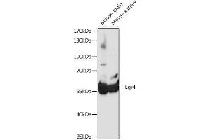 Western blot analysis of extracts of various cell lines, using Egr4 antibody (ABIN7266889) at 1:1000 dilution. (EGR4 Antikörper  (AA 1-367))