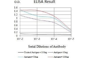 Black line: Control Antigen (100 ng),Purple line: Antigen (10 ng), Blue line: Antigen (50 ng), Red line:Antigen (100 ng) (TR4 Antikörper  (AA 62-356))