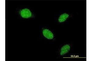 Immunofluorescence of monoclonal antibody to AHR on HeLa cell. (Aryl Hydrocarbon Receptor Antikörper  (AA 721-820))