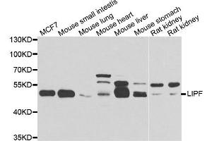 Western blot analysis of extracts of various cell lines, using LIPF antibody. (LIPF Antikörper)